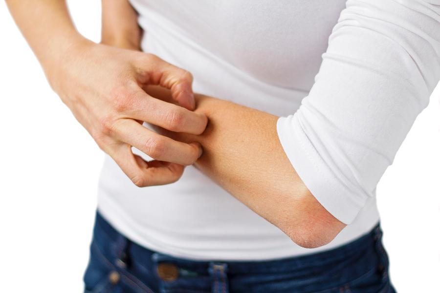 Keratosis Pilaris causes bumps on your arms.