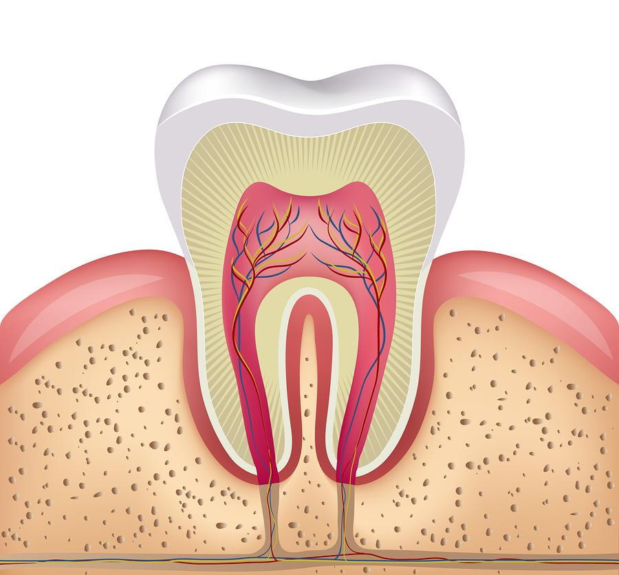 root canal