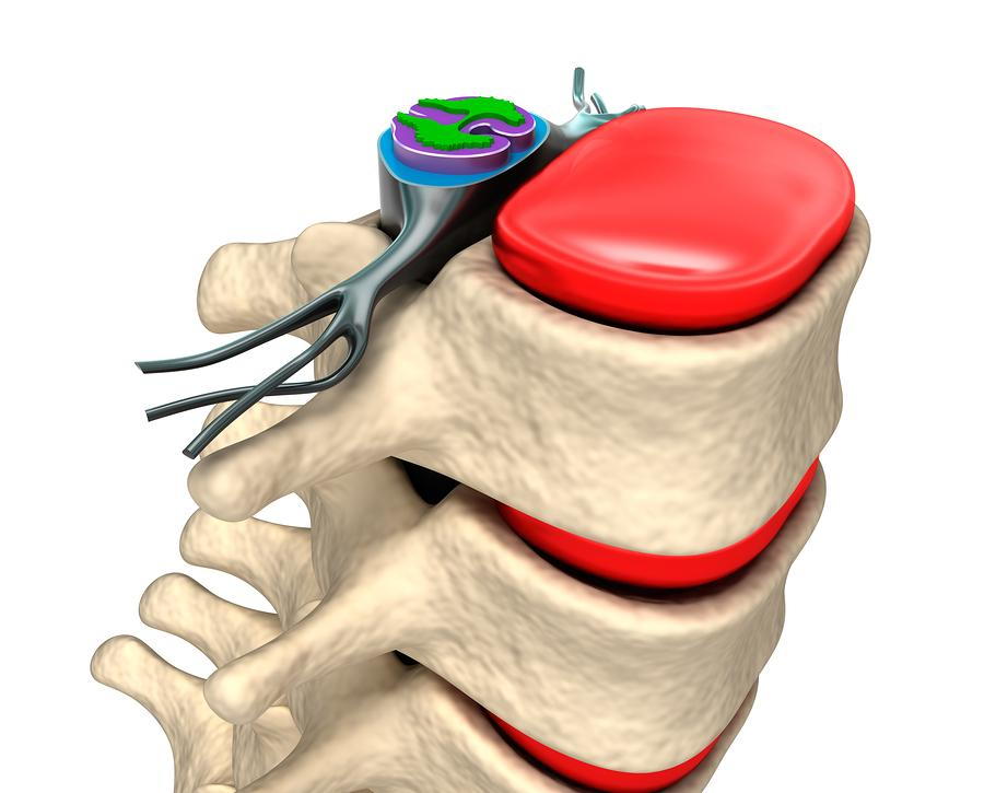 Physical Therapy in our clinic for Pain Care Spinal Cord Stimulators