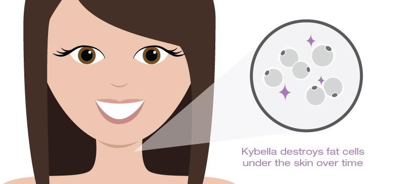 Kybella | Anders Dermatology