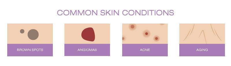 common skin conditions | Anders Dermatology