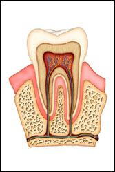 root canal