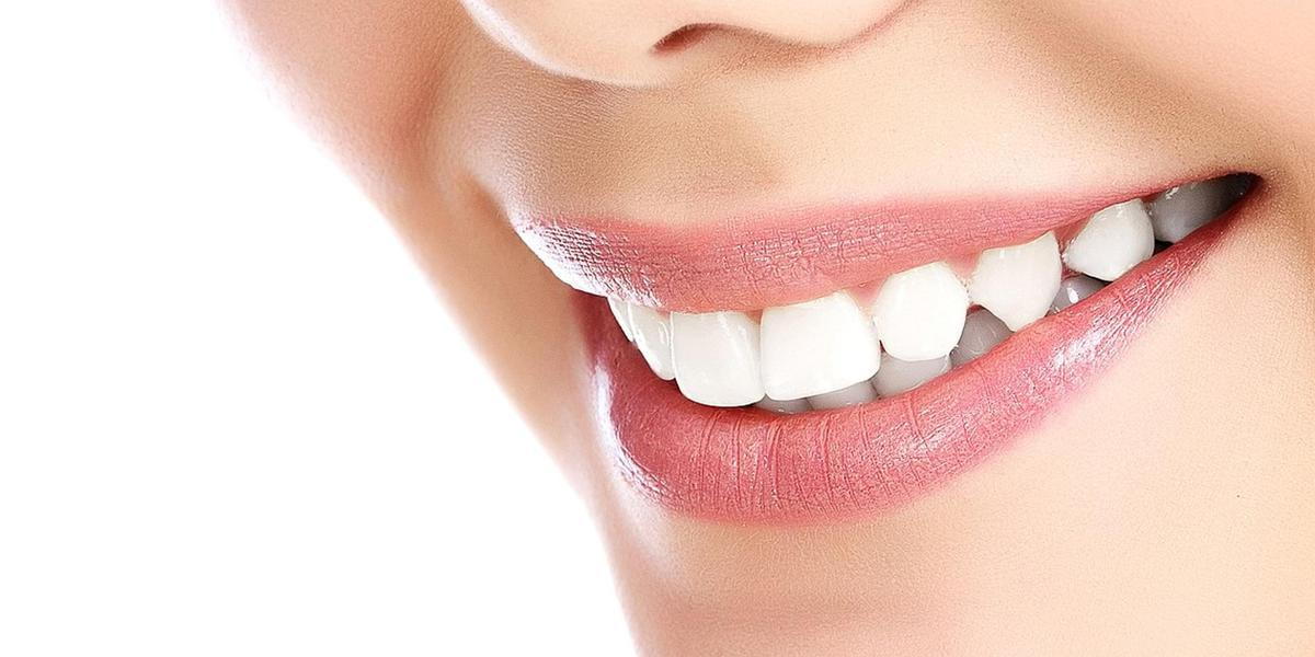 Esthetic Smile - Dr Najafi at Origins Dentistry