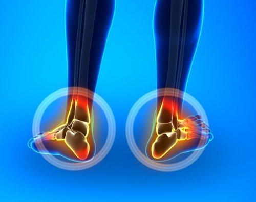 treatment for heel pain, plantar fasciitis and achilles tendonitis with shockwave therapy