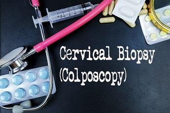 Cervical Biopsy, Endometrial Biopsy, Uterine Biopsy and Colposcopy