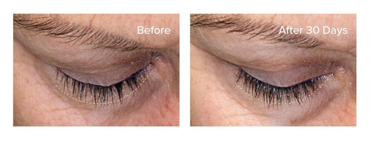 Growlash before and after