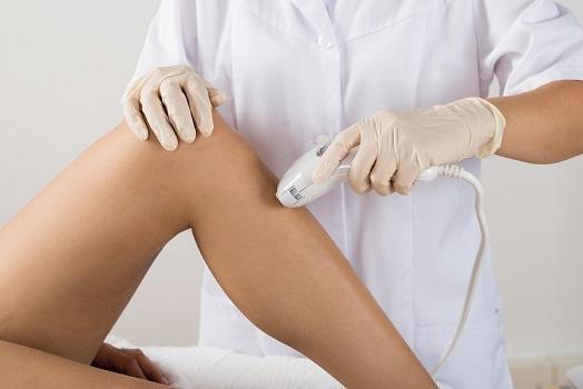 Laser_hair_Removal