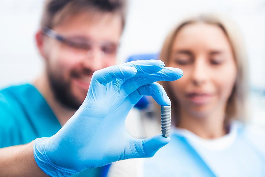 Common questions about Dental Implants