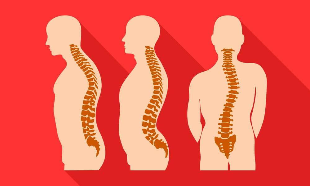 Why is good posture important? - Spectrum Chiropractic Natural Family  Healthcare