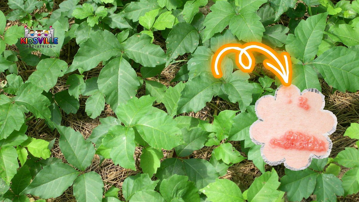 A field of poison ivy and a close-up of a rash.