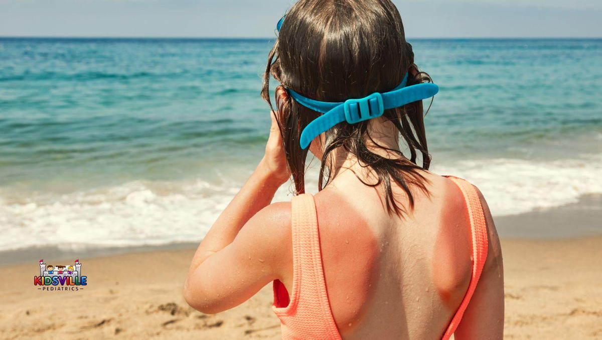 A young woman with blue goggles, sunburned, on a sunny day at the beach.