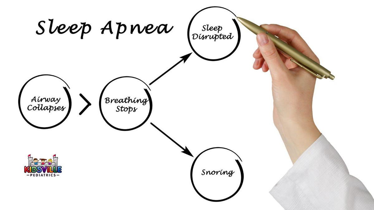 Sleep apnea whiteboard illustration drawn by a hand.