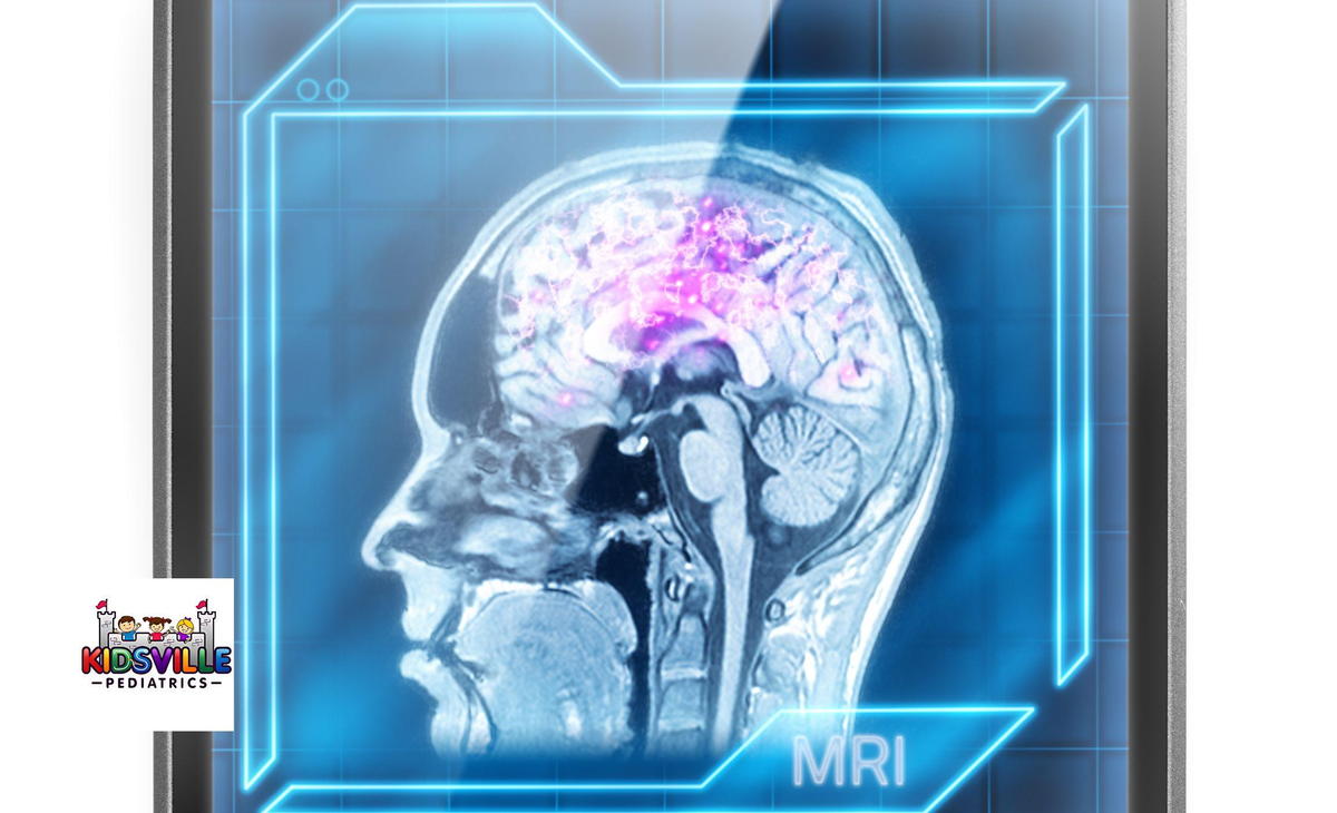 An MRI scan of a head indicating epilepsy.