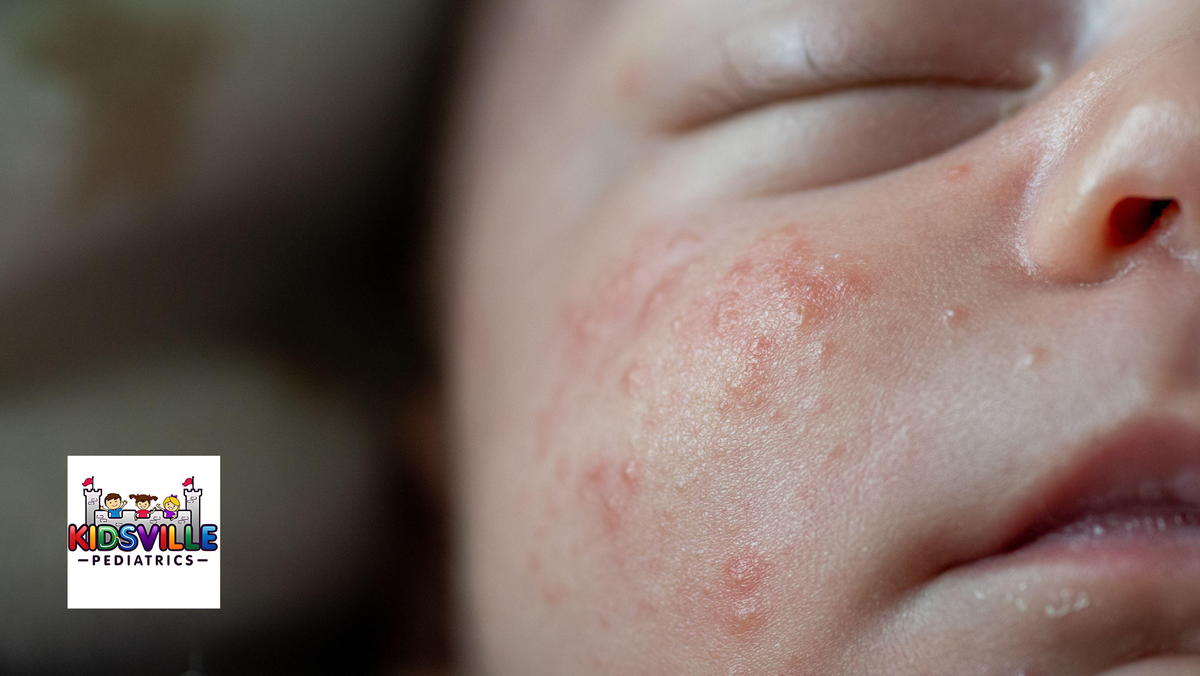 Essential Infant Skin Care Tips from Your McKinney Pediatricians