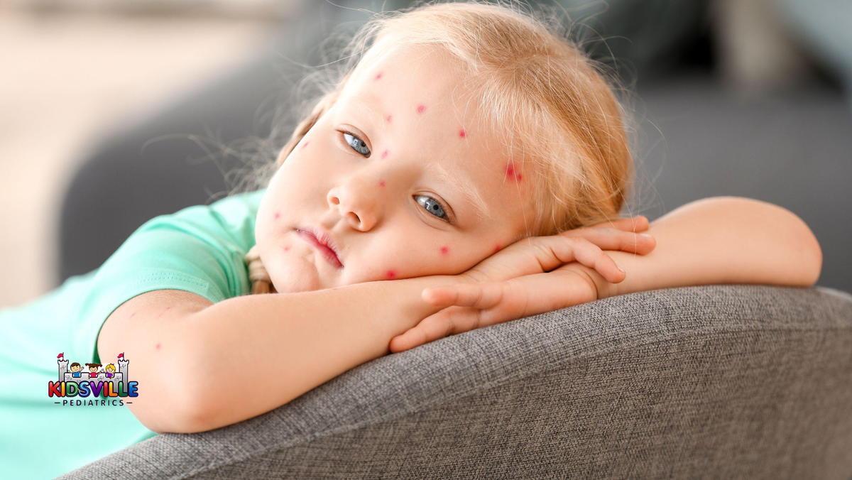 Little Girl Ill with Chickenpox at Home