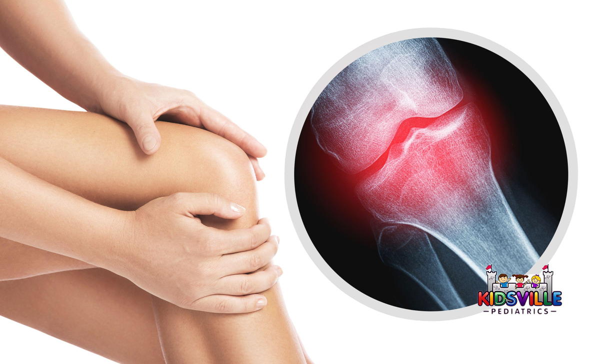 Knee and and -Ray Effect with an Injured Joint