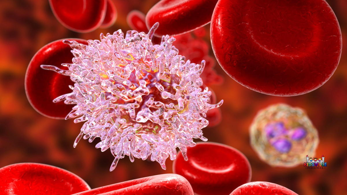 Hairy cell leukaemia