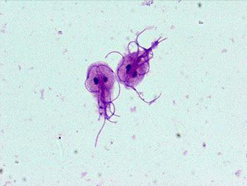 Bellalago Protozoa Microscope Diarrhea