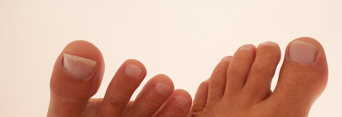 KERYflex NAIL RESTORATION SYSTEM IMPLEMENTED IN PROMINENT TORONTO FOOT  CLINIC