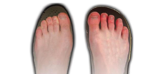 Why Do Women's Feet Get Bigger As They Age? - Walkrite Foot Clinic