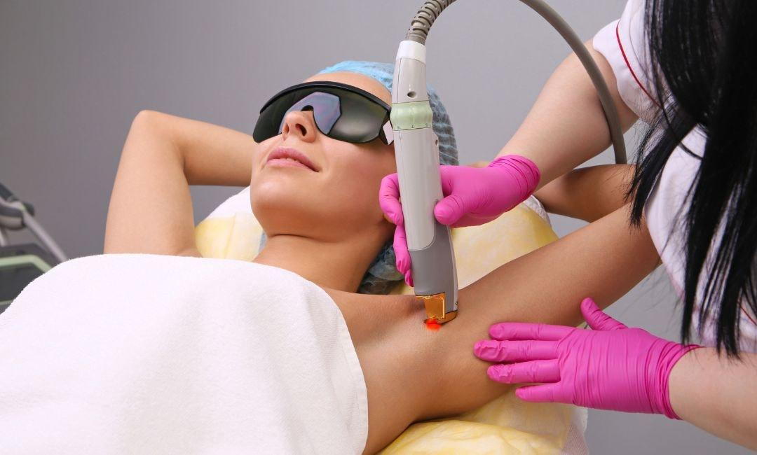 Laser hair removal on arm pit