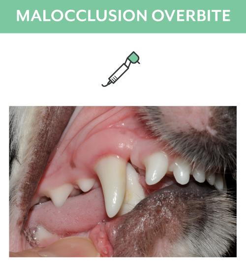 Malocclusions Overbite