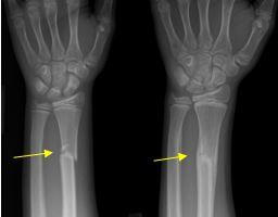 wrist x-ray