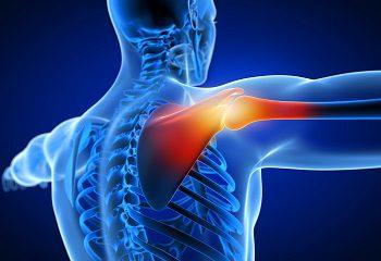 Shoulder Pain: Causes and Chiropractic Solutions 