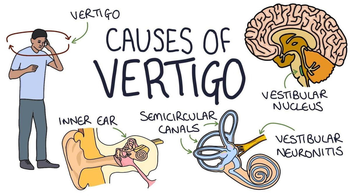 dizziness causes