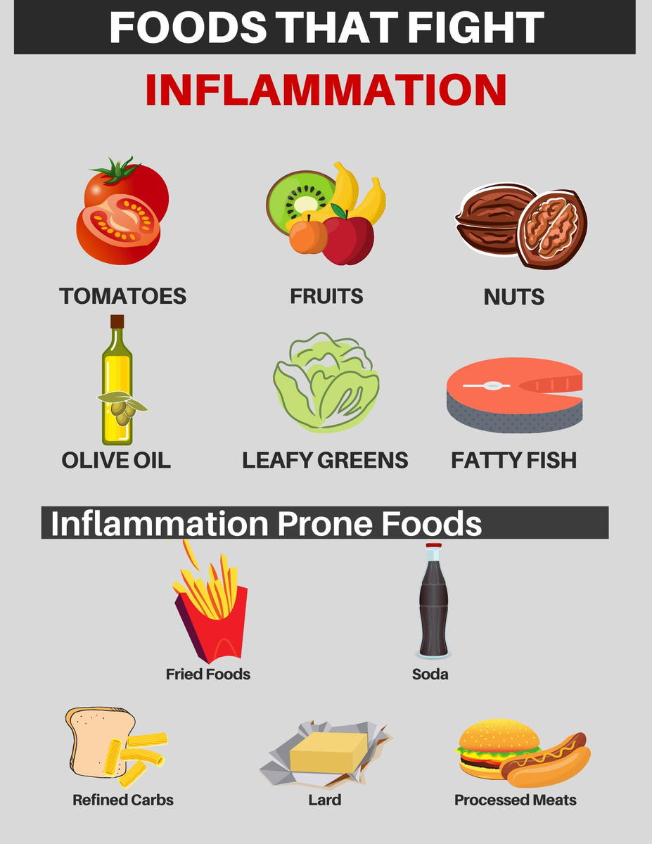 Foods that fight inflammation and foods that create inflammation. Gallatin valley chiropractic bozeman montana.