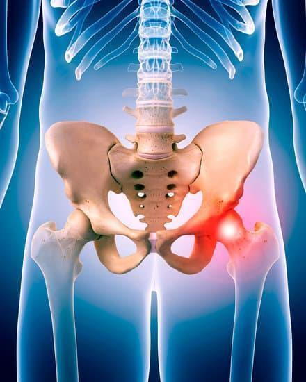how to manage hip impingement with chiropractic care