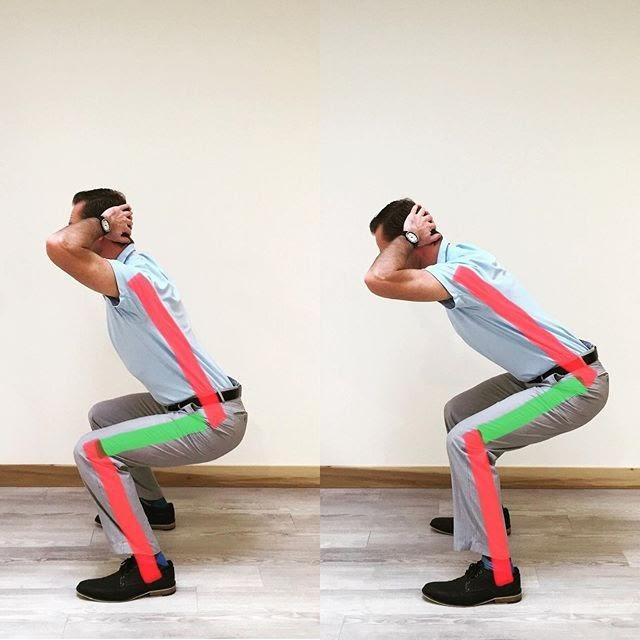 LOW BACK PAIN AND SQUATTING ⁣ •⁣ Many times low back pain comes out of nowhere with no major mechanism of injury. This is why it’s important to be able to assess how someone moves. Today’s example is looking at a squat from a side view.⁣ •⁣ Reports say that we bend forward 2-4000x/day. If you are not using proper muscles with this repetitive motion, you are continuously adding stress to an area that will eventually create symptoms.⁣ •⁣ Think of getting into and out of your car, sitting in chair, getting up from chair, bending to pick something up.. You are performing a squat, and hopefully it looks good!⁣ •⁣ The picture on the left shows more parallel RED lines, this is correct✅. Right side shows me bending way too far forward with upper back, RED lines are not parallel .⁣ •⁣ These are ideal moves with a typical squat. If you are unable to perform a squat with a somewhat upright back, then see the next photo. (There are a variety of reasons why upper body cannot stay upright, and a functional assessment ⁣should be performed to find the root of the problem) •⁣ I am simply using an exercise band to assist me in staying more upright when performing a squat. You’ll notice this is much easier to stay in correct form during the squat. •⁣ This is a great move to perform to your tolerance if you are dealing with back pain. You need to “retrain” your brain on how to move properly and use the correct muscles with a squat. ⁣ •⁣ •⁣ •⁣ •⁣ •⁣ •⁣ •⁣ #squat #squatting #glute #glutes #exercise #muscle #strength #lowback #lbp #lowbackpain #chiro #chiropractor #sportsdoc #holland #hollandmi