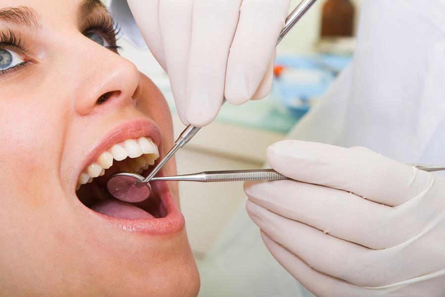 Plastic Fillings  Advantages of Composite Tooth Colored Fillings