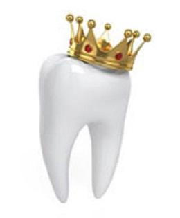 dental crowns