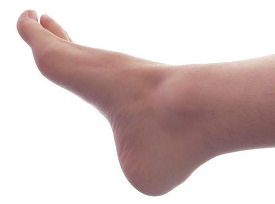 foot-pain4.jpg