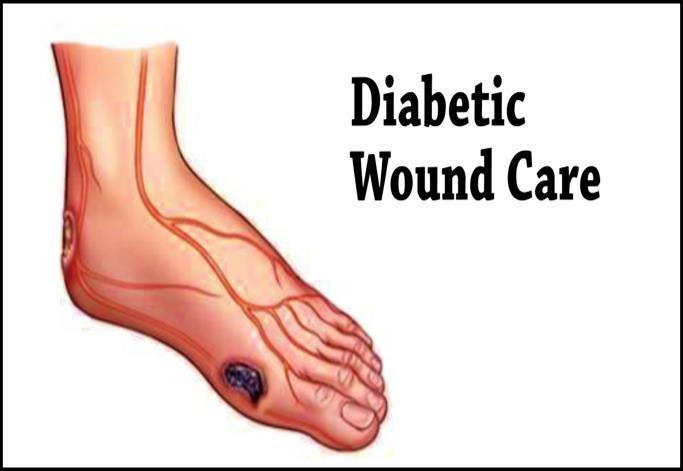 Description: C:UsersjeffreyDesktopGary's PhotosDiabetic Wound Care.bmp