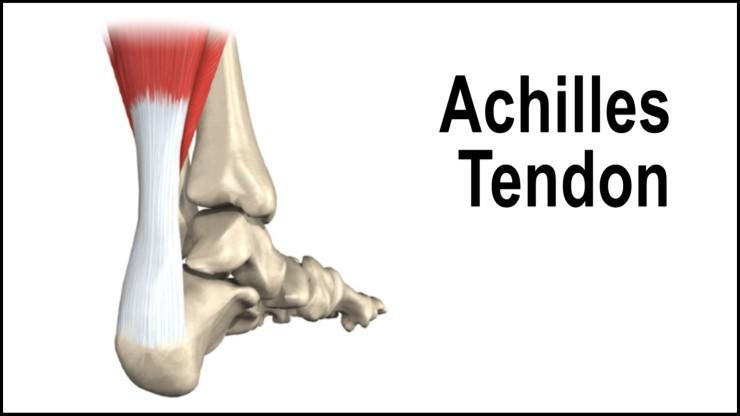 achillles tendon