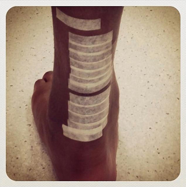 Description: Last week Kobe Bryant shares a photo of his bandaged leg with the message: â€˜Foot on the ground! #pray4bear #standup #mambaarmyâ€™