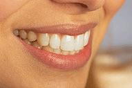 Tips for Lasting Teeth Whitening