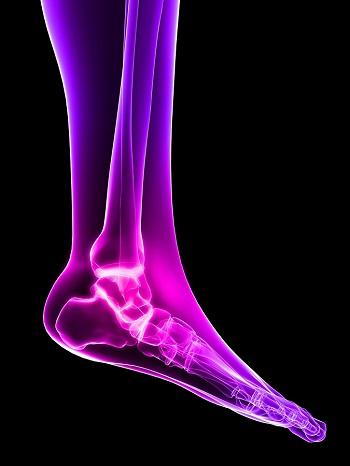 Chronic Ankle Instability: How to Strengthen Weak Ankles