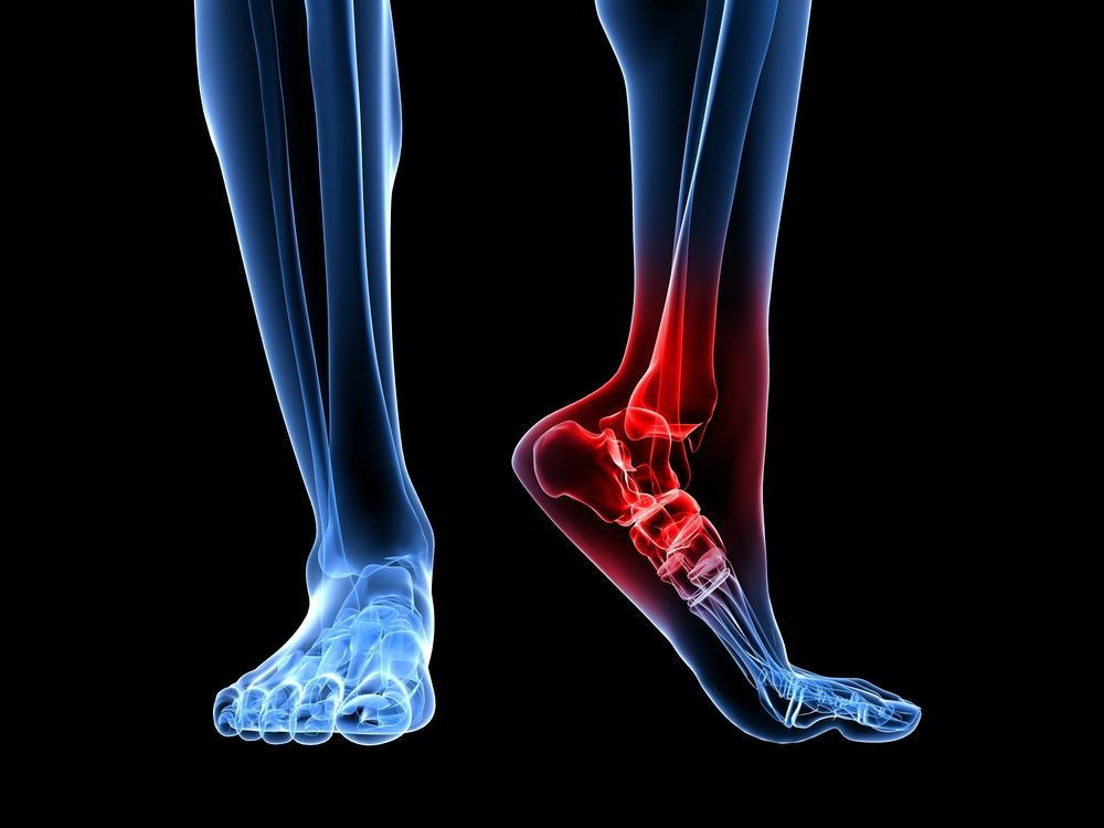 Pain On Outside Of Foot: Causes & Treatment Of Lateral Foot Pain