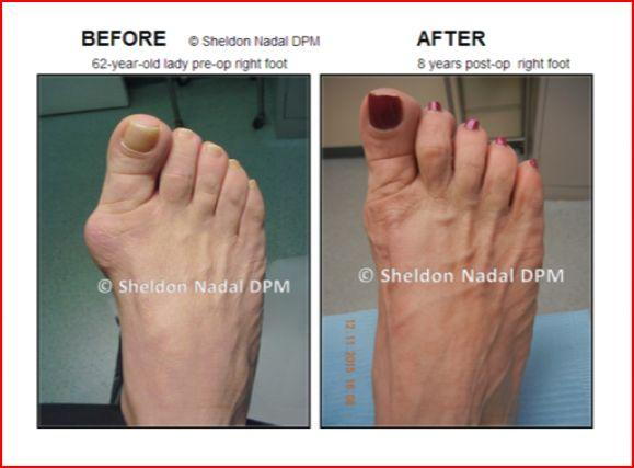 Toronto,Podiatrist, Foot Doctor, Foot and Ankle Surgery, Heel Pain, Orthoti...