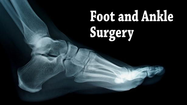 foot-surgery2.jpg