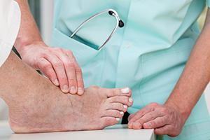 Foot Bunion Treatment