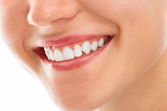 what is alloderm gum grafting mississauga dentist