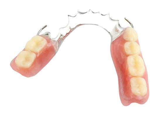 partial dentures mississauga on dentist mississauga dental arts