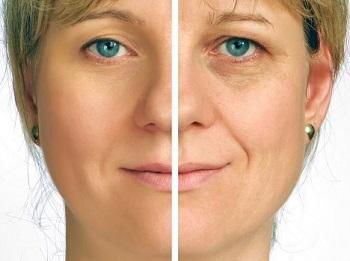 Woman with and without wrinkles