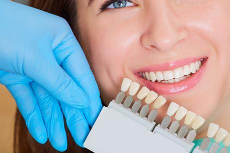 article_teeth_whitening_dentist.jpg