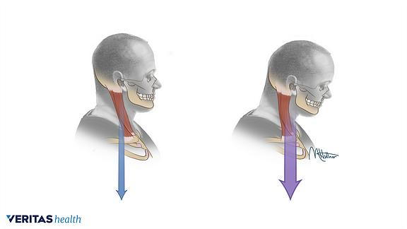 Proper-head-posture-vs-Forward-Head-Tilt.png?u=at8tiu&use=idsla&k=c