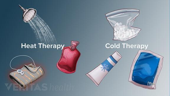 Medical illustration of the different types of heat and cold therapies including hot water bottle, hot shower, heating pad, bag of ice, ice pack, cooling cream